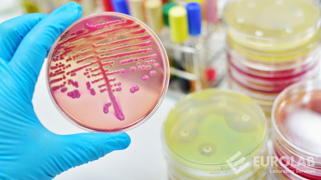 ISO 7932 Gıda ve Hayvan Yemlerinin Mikrobiyolojisi - Varsayımsal Bacillus Cereus Sayımı İçin Yatay Yöntem - 30 Derecede Koloni Sayımı Tekniği