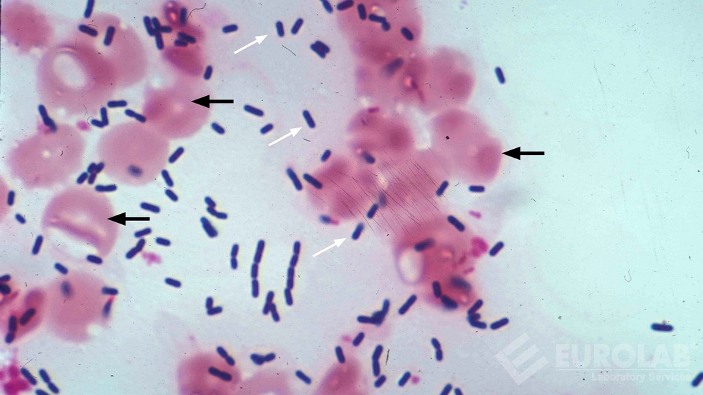 Listeria spp. Aranması