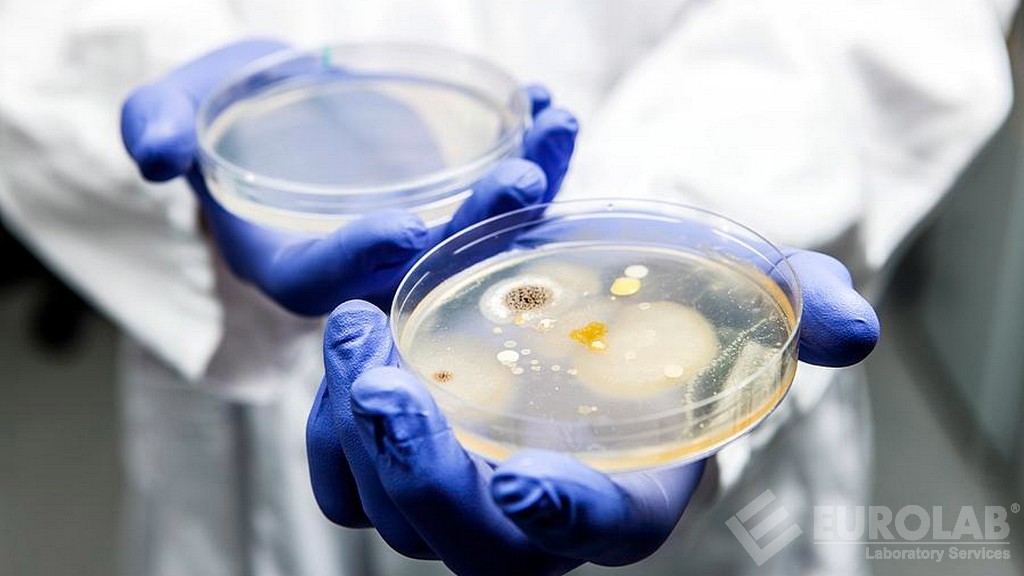 Mikrobiyal Tanım Testi