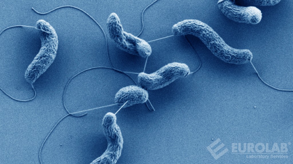 Vibrio spp Vibrio parahaemolyticus ve Vibrio cholerae Aranması